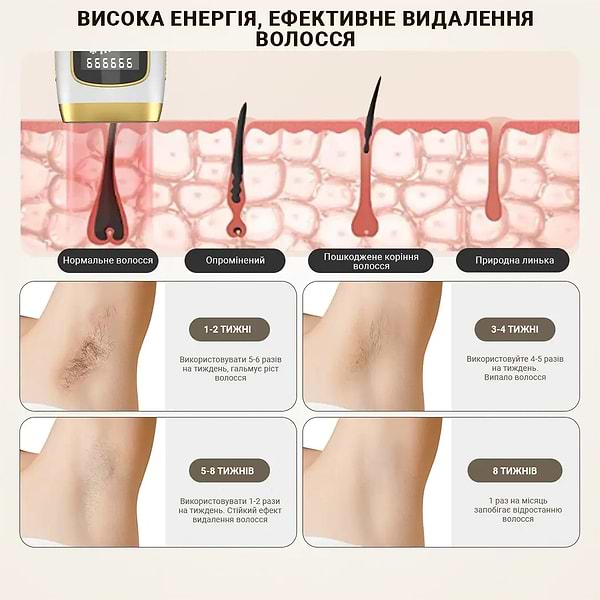 Фото - Фотоепілятор INSPIRE Sapphire XM-L011Bk