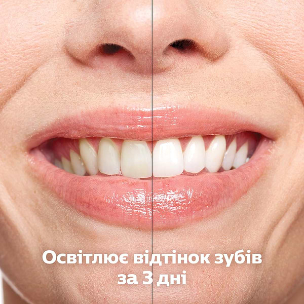 Фото - Зубна щітка електрична Philips HX9917/88