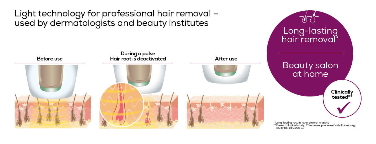 Фото - Фотоэпилятор Beurer IPL Pure Skin Pro