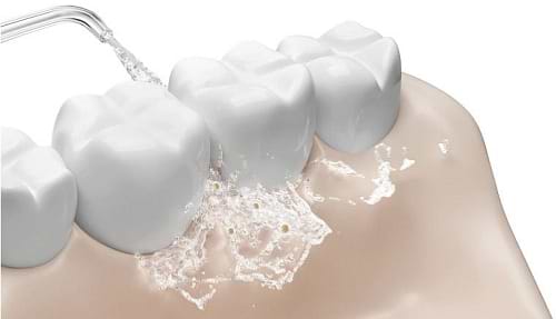 Фото - Іригатор Xiaomi Water Flosser 2 EU