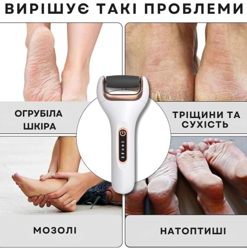 Фото - Електрична роликова пилка AIMED Foot Master Classic (AI-FootM_Classic1_wh)