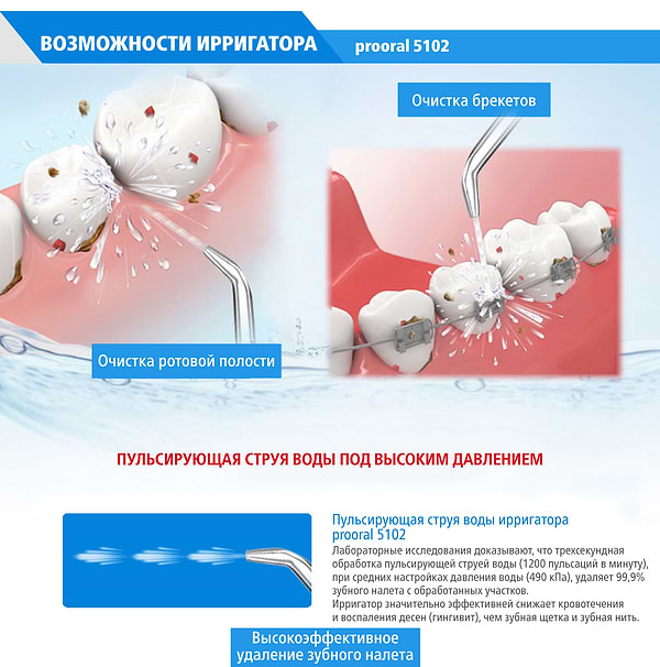 Фото - Ирригатор Prooral 5102