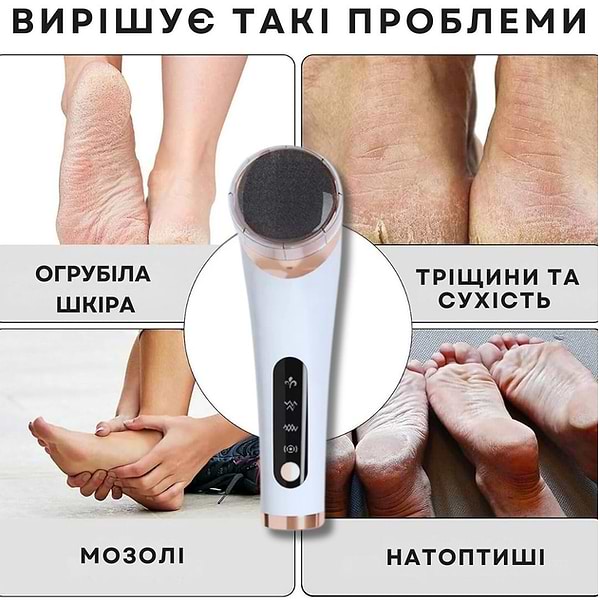 Фото - Електрична роликова пилка AIMED Foot Master Round White (AI-FootM_Round2_wh)