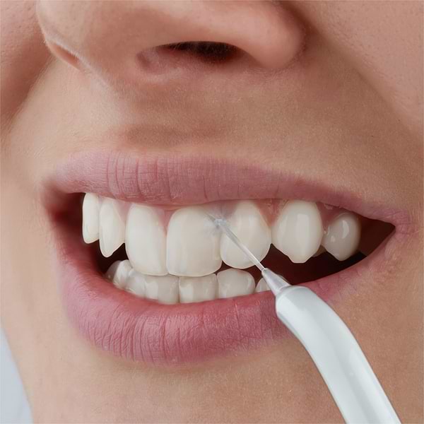 Фото - Ирригатор Sencor SOI1100SL