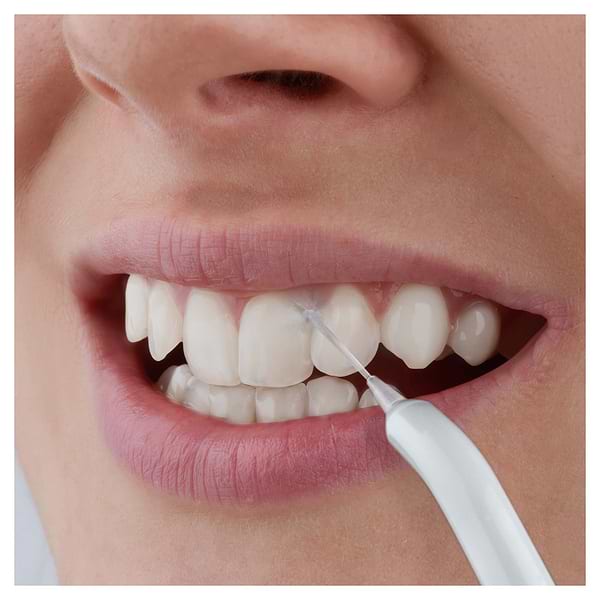 Фото - Ирригатор Sencor SOI2202TQ