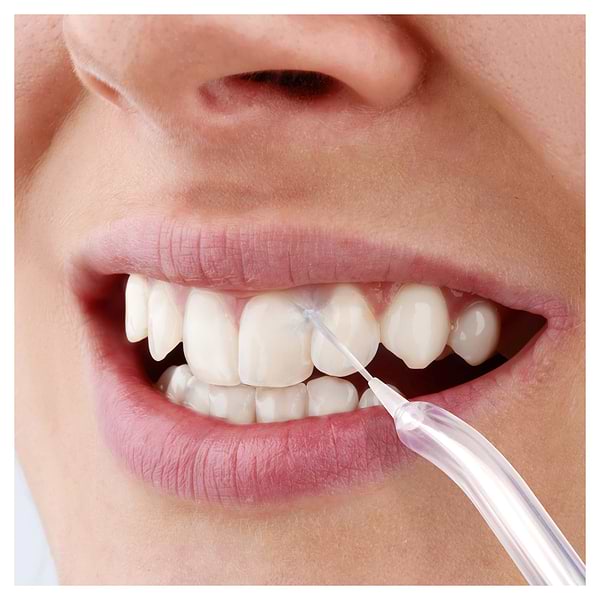 Фото - Ирригатор Sencor SOI3312WH