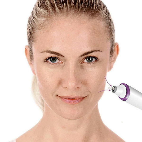 Фото - Вакуумний очищувач шкіри та пор Beurer FC 76