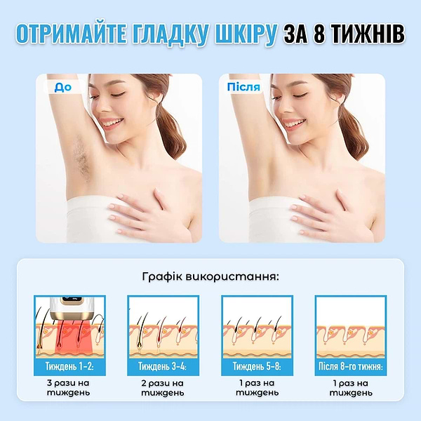 Фото - Фотоэпилятор INSPIRE W-1095A White